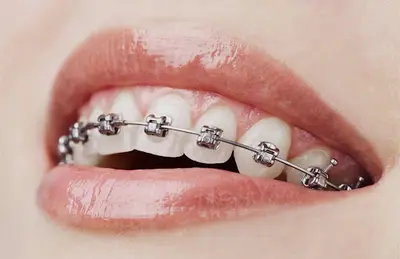Dr Caroline Diemunsch-orthodontiste Spécialiste