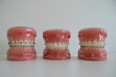 Dr Sophie Stolz - Spécialiste en Orthodontie