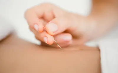 Dr Sage-femme Acupunctrice Mathilde Bony Angers