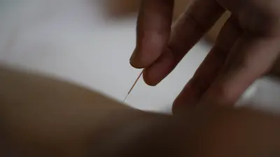 Dr Alexandre Karam - Acupuncture Traditionnelle Chinoise