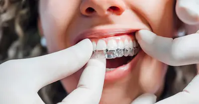 Dr Cabinet du Sourire / Orthodontie et Pédodontie