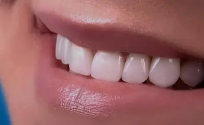 Dr Drs Hadrian Otelescu & Laurent Cardinaux - Votre Sourire