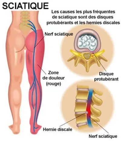 Rebouteux Magnétiseur Passeuse d'Âme, Nettoyeuse Chamanique Soins Diapason Soin Energétique, Cartomancienne Soin Lahochi