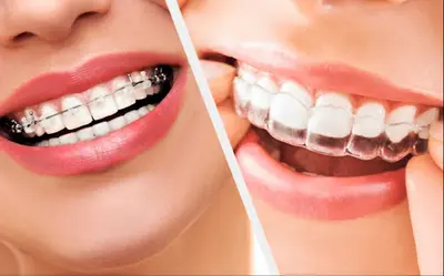 Dr Cabinet D’orthodontie de L’ondaine - Dr Bassel Farhat