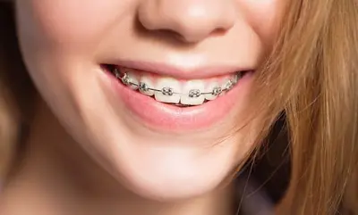 Dr David Atlan - Orthodontiste