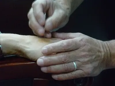 Dr Yann Cordonnier - Acupuncture