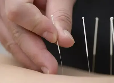 Dr Didier Duverger Acupuncture et Massage Traditionnel Chinois