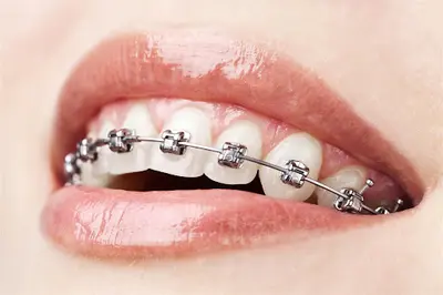 Dr Orthodontie les Pennes Mirabeau