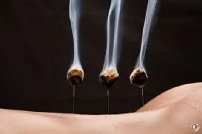 Bobenrieth Bénédicte, Sage Femme Acupuncture