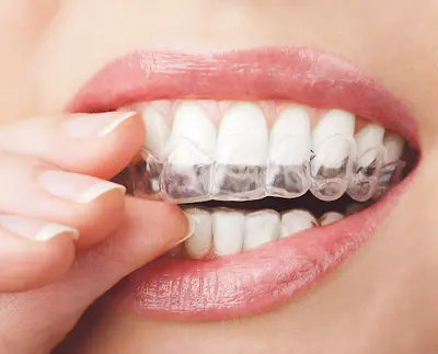 Dr Orthodontie Pépinière Lorient