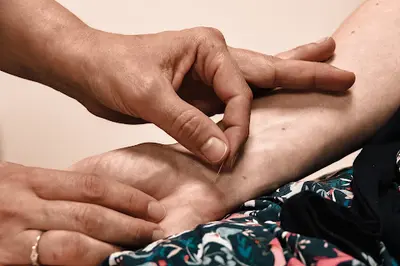 Dr Acupuncture Marie Casanova Montpellier