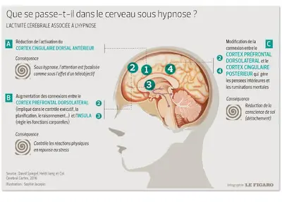 Hypnotherapeute | France Laon Veslud Parfondru