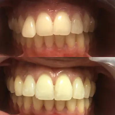 Dr Sarah Benazra Orthodontie Enfants et Adultes Invisalign 75 - 91