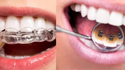 Cabinet d'Orthodontie Orthomontmartre - Drs Jean-marc Bellaiche et Deborah Elstejn