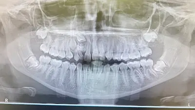 Dr. Quilarque Yris. Spécialiste en Orthodontie Odf