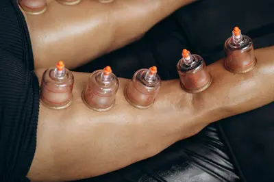 l'Iliade - Kinésiologie . Massage Traditionnel . Hijama .