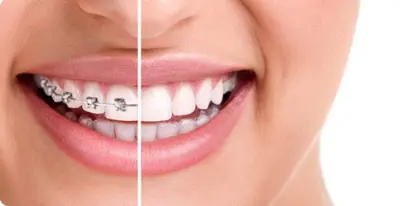 Dr Septemes Sourires - Pratique Limitée À l'Orthodontie