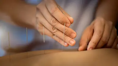Dr Elodie Ammon - Acupuncture