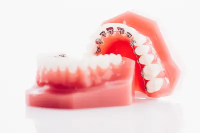 Dr Cabinet d'Orthodontie - Dr Koch Jean