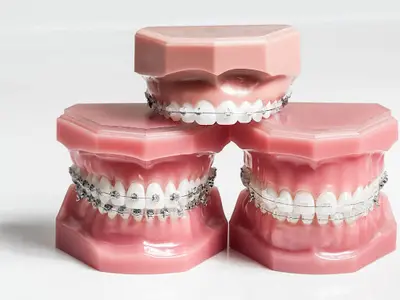 Dr Orthodontie - Suresnes