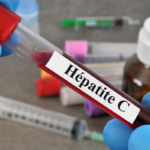16 Hépatite C