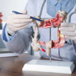 3 Cancer colorectal