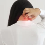 Fibromyalgie