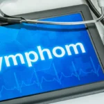 lymphome