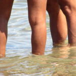 infections estivales