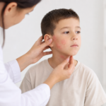 Problèmes de peau chez les enfants : quelles sont les affections les plus courantes ? article-problemes-de-peau-chez-les-enfants-quell-2026-06-11T13-51-41-651Z