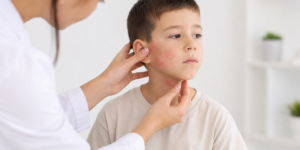 Problèmes de peau chez les enfants : quelles sont les affections les plus courantes ?