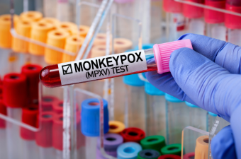 vaccination-variole-singe